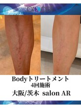 メンズサロンアール(AR)/プロセルセラピーズ