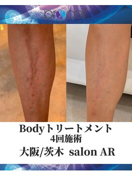 メンズサロンアール(AR)/プロセルセラピーズ