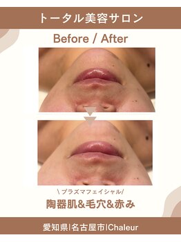 シャルール プラス(Chaleur+)/