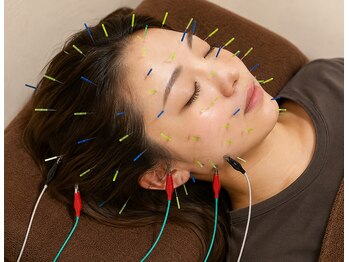 なかむら鍼灸整骨院の写真/《国家資格者による本格鍼灸施術》不調の原因を突き止め速攻アプローチ!心も体も健康的に整えます◎