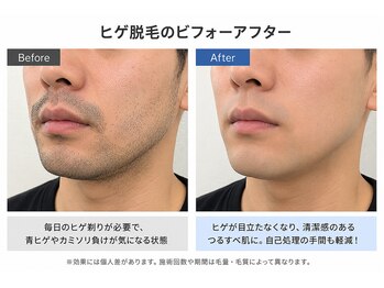 ラグジー 本八幡店(LUXY)の写真/毎日の簡単な髭剃りのお手入れへの第一歩！