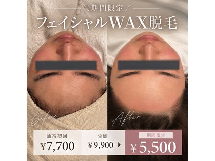 エクラ(eclat)の写真