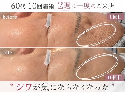 エーサロン(A-Salon)の写真