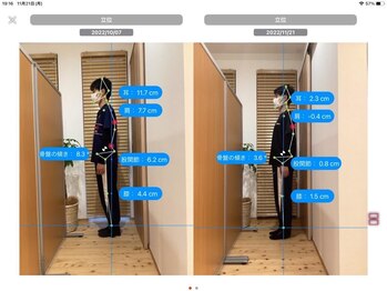きのて整体院/AIを使った姿勢の分析◎