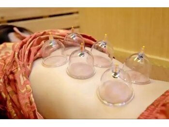 本格台湾式マッサージ 優心苑/施術風景（カッピング）