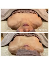オクノマ(OKUNOMA)/【お客様BeforeAfter】