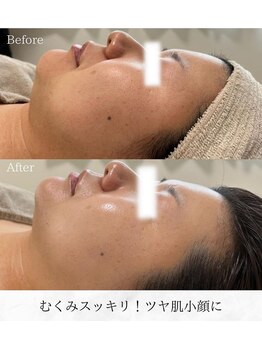 シロ(silo)/毛穴、むくみをスッキリ解消!