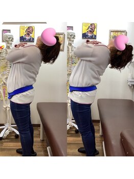 ヒデ整体院(Hide整体院)/猫背矯正骨盤矯正B/A肩こり腰痛