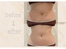 アンバー 恵比寿(AMBER)/姿勢改善してくびれ作り◎