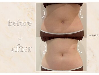 アンバー 恵比寿(AMBER)/姿勢改善してくびれ作り◎