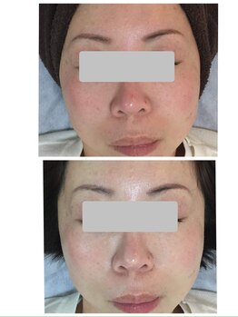 デイスパ コオリナ(DAYSPA Ko olina)/透明感◎毛穴レス◎