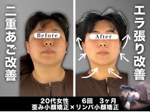 エレヴィザ トウキョウ 恵比寿院(ELVISA TOKYO)の雰囲気(口腔内小顔&リンパ小顔/恵比寿/渋谷/小顔/小顔矯正/骨盤/肩こり)