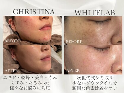 トータルビューティーサロン ルース(LUZ)の写真