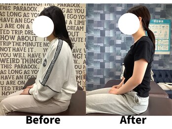 リセラ(Re:seraph)/Before After