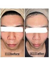 ミニョン(mignon)/男性の方も！ご来店出来ます