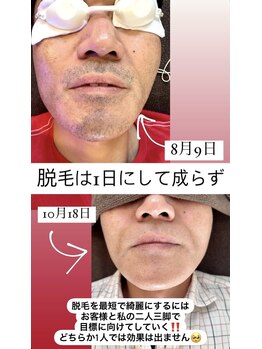 サロンドスパ(Salon de Spa)/ビフォーアフター