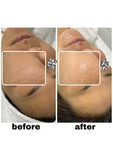 エクスクラメーションマーク(!!!)/韓国肌管理セット