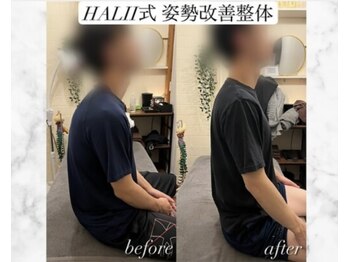 ハリートウキョウ(HALII TOKYO)/姿勢から腰痛改善【ヘッドスパ】