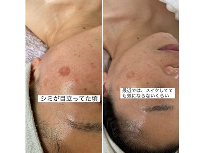 リュミエール(Lumie're)の写真