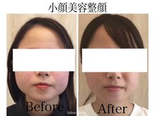 サロンベイビー 西宮本店(Salon Baby)