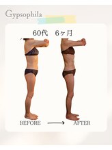 ジプソフィラ(Gypsophila)/痩身ビフォーアフター