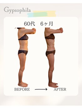 ジプソフィラ(Gypsophila)/痩身ビフォーアフター
