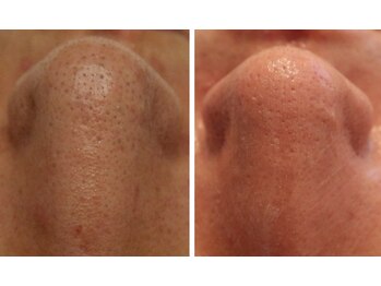 ニコリ(NICOLI)/結果重視！お任せください