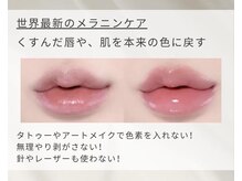Kino Beauty Salon二子玉川店 ローマピンク/ホワイトラボ/脂肪冷却/シミ/メラニンケア/ローマピンク【唇/リップ】