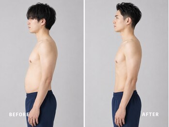 ミネルバ(MINERVA)/【施術例】 30代男性 痩身