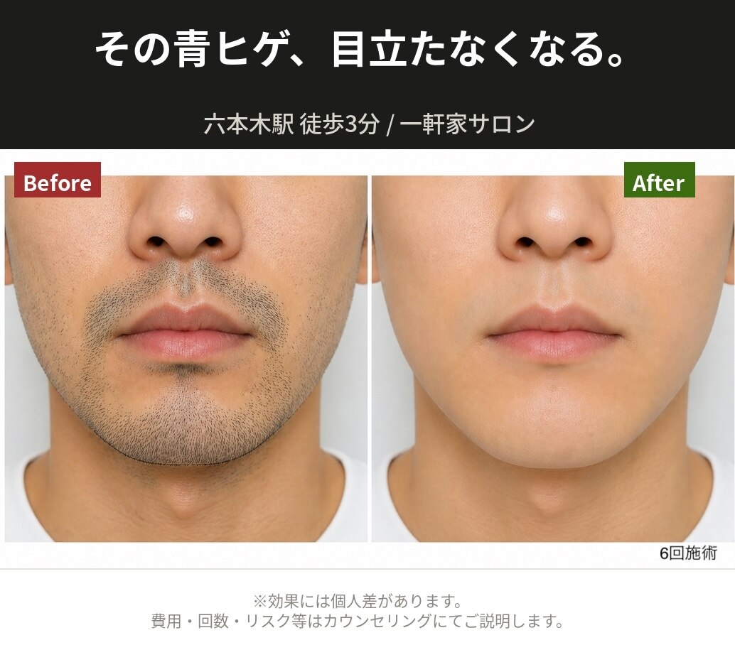 エクラ 六本木(eclat)｜ホットペッパービューティー