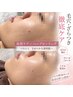 【毛穴・ざらつき徹底ケア】W角質ケア×ハーブピーリングで透明感ある艶肌へ