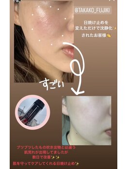 アローナ(ARONA)/spicare正規取扱店です！