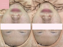 ミュー 名駅店(mieux)/お客様Before/After