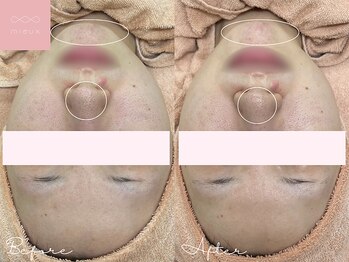 ミュー 名駅店(mieux)/お客様Before/After