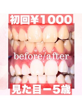 ホワイトサロン/3来店でこの結果に！