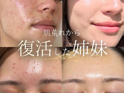 ミーラヤ(MILAYA)の写真