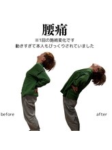 整体院チルアンドママ(CHILL&mama)/産後の腰痛