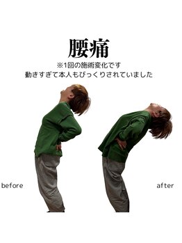 整体院チルアンドママ(CHILL&mama)/産後の腰痛