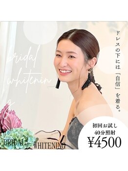 ホワイトニングショップ 加古川店の写真/特別な日に向けて…◇当店独自の最高品質ジェルを使用し、リーズナブルな価格で圧倒的な白さを実現♪