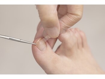 コバコ(kobaco)の写真/巻き爪ケアができるサロンで足のお悩みをサポート！プロの技術で健やかな美爪へ☆