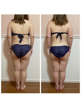 トータル フィルシャイン(Total Fillshine)/痩身モニター様☆★