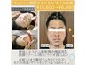 No.2【メンズ小顔矯正リラクフェイシャル】筋膜リリース首肩こりリンパ整体☆
