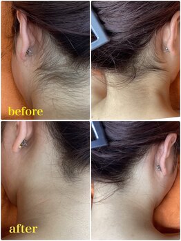 ドマーニプラス 岐阜シティタワー43店(DOMANI PLUS.)/えり足の脱毛で清潔感UP！