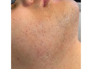 ラッシュ(RUSH)/3回目でこの抜け感!