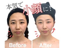 小顔フェイスラボ 四日市店(小顔FaceLabo.)