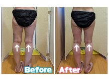 ヨサパーク デュランタ(YOSA PARK duranta)