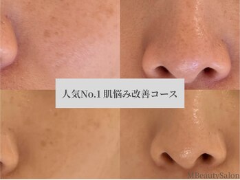 エムビューティーサロン(M Beauty Salon)