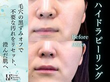 毛穴レスな肌へ導き透明感と潤いのある美しい仕上がりを実現します