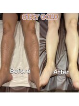 ステイゴールド 新百合ヶ丘(STAY GOLD)/足脱毛！