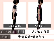 姿整美/姿勢矯正見た目年齢マイナス20歳